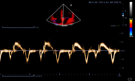 IMAGEM DOPPLER TECIDUAL